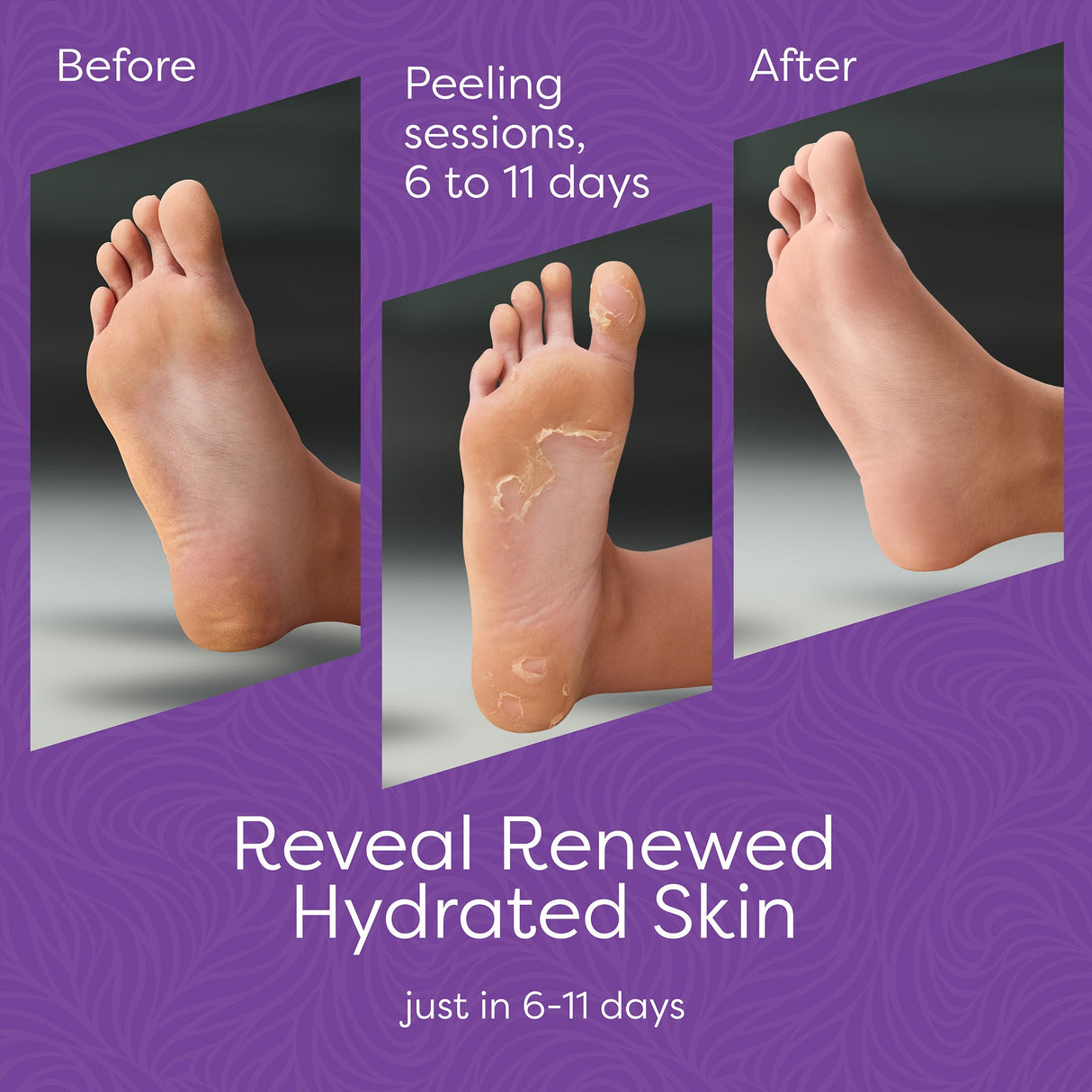 Aesta 3-in-1 Foot Peel Mask, Full-Cycle Foot Care: Revitalizing Mousse + Feet Peeling Mask + Moisturizing Cream | All-Natural Foot Peel Mask for Dry Cracked Feet | Baby Feet Foot Peel Treatment Set from REATHLETE
