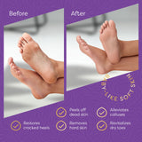 Aesta 3-in-1 Foot Peel Mask, Full-Cycle Foot Care: Revitalizing Mousse + Feet Peeling Mask + Moisturizing Cream | All-Natural Foot Peel Mask for Dry Cracked Feet | Baby Feet Foot Peel Treatment Set from REATHLETE