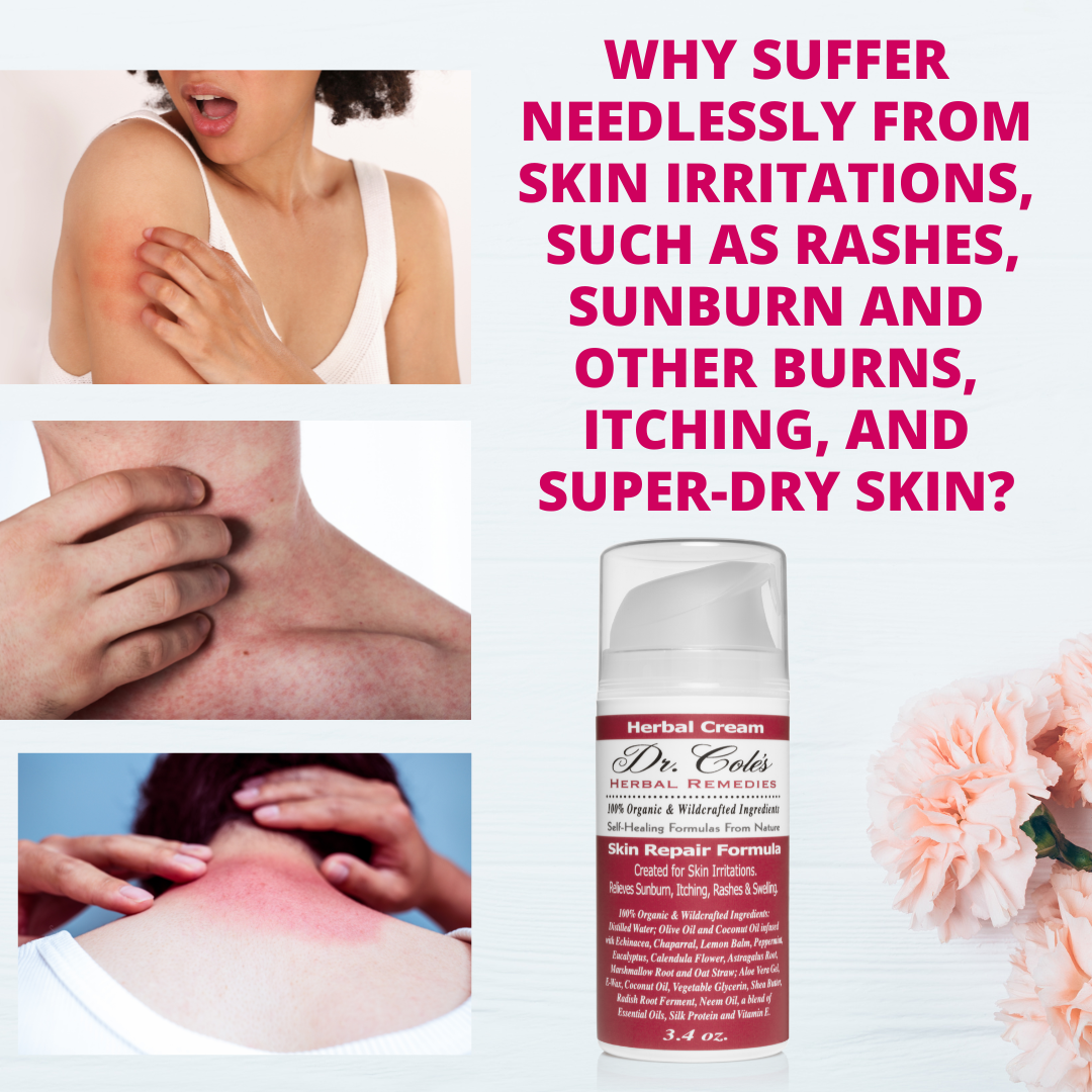 Dr. Cole's Organic Skin Repair Herbal Cream from COLEHERBALS