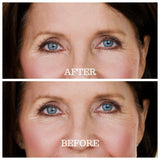 Skin Plumping Under Eye Mask [Reusable] from Dreambox Beauty