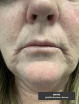 [pH]iller Peptide+ Serum from the [pH]ix