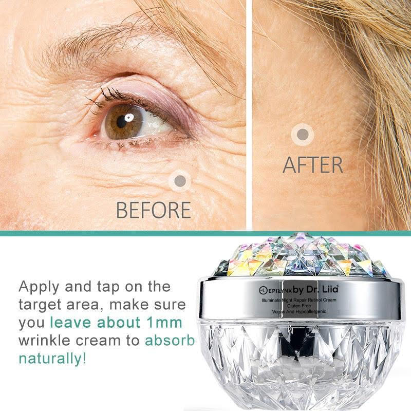 Illuminate Night Repair Retinol Cream from Epilynx Skincare and Cosmetics