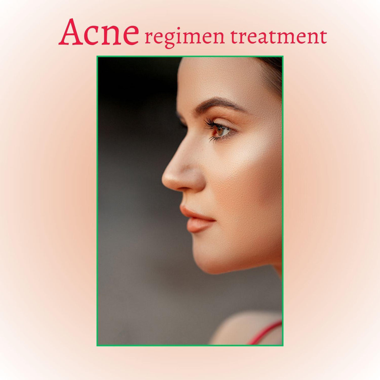 Deep Treatment Acne Cleansing Foam Cleanser from gymsegbë