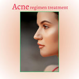 Acne Set: Cleanser, Toner, Serum, and Acid Peel from gymsegbë