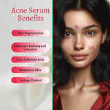 Acne Set: Cleanser, Toner, Serum, and Acid Peel from gymsegbë