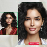 New Skin Natural Intensive Acne Serum from gymsegbë