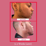 Dynamic Toner from gymsegbë