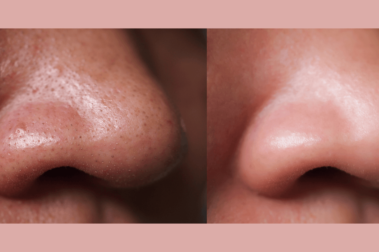 Ultra-Advanced Anti-Aging Daily Resurfacing Pads from gymsegbë