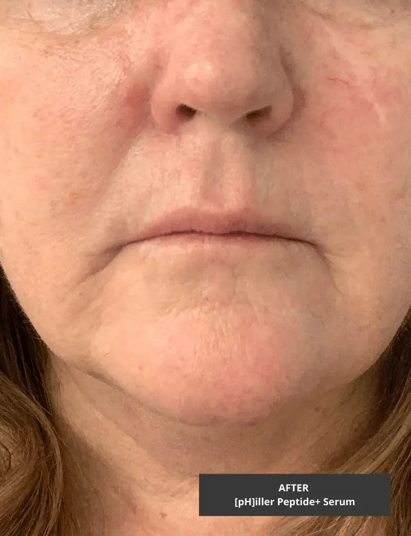 [pH]iller Peptide+ Serum from the [pH]ix