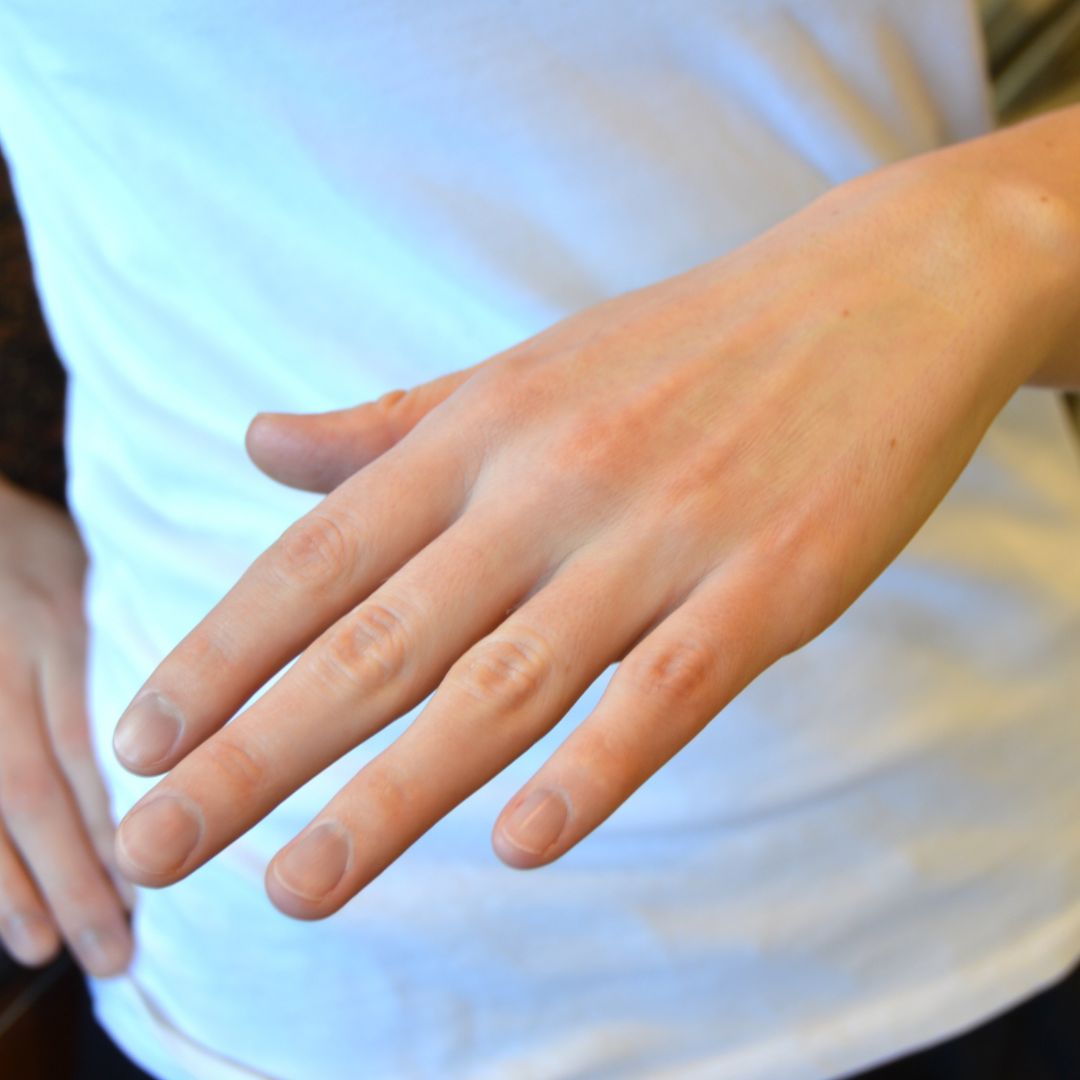 Naked Bandage® from SilverCeuticals