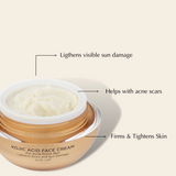Moisturizer Set for Acne Prone Skin and Acne Scars - Brightening from Epilynx Skincare and Cosmetics