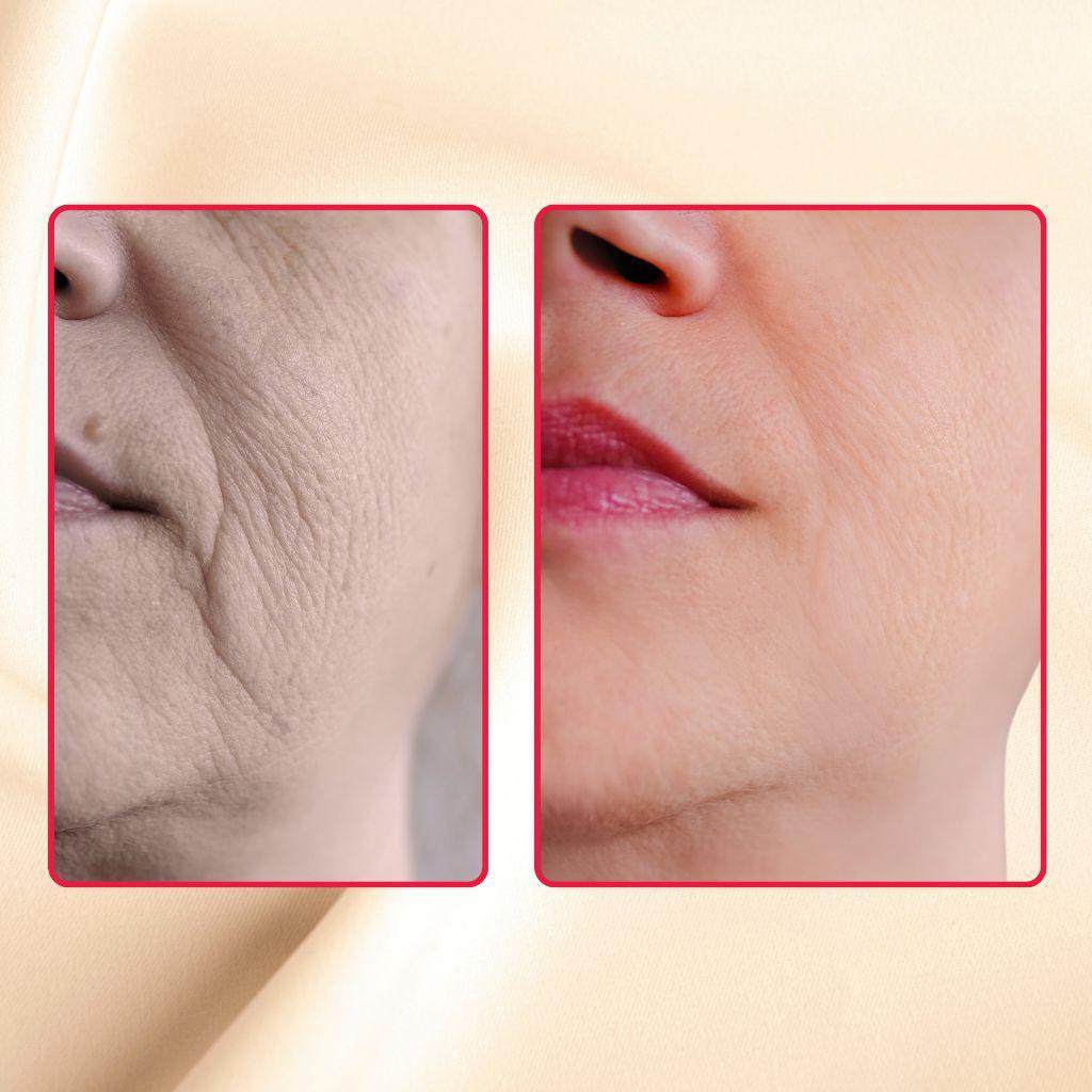 Luminous Mighty Punch Serum Skin Renewal, Anti-Aging and Brightening from gymsegbë