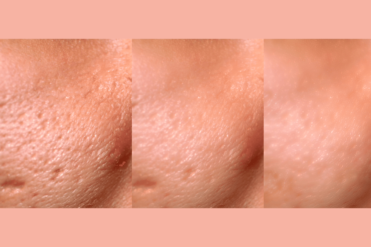 Ultra-Advanced Anti-Aging Daily Resurfacing Pads from gymsegbë
