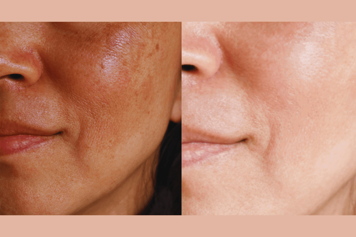Ultra-Advanced Anti-Aging Daily Resurfacing Pads from gymsegbë