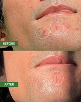 Oil Control Dual Action Blemish Patches From Sand and Sky