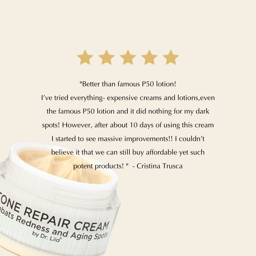 FLASH SALE: Brightening Face Cream for Redness & Hyperpigmentation from Epilynx Skincare and Cosmetics