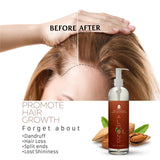 100% Pure & Natural Sweet Almond oil 16 Oz. from Pursonic