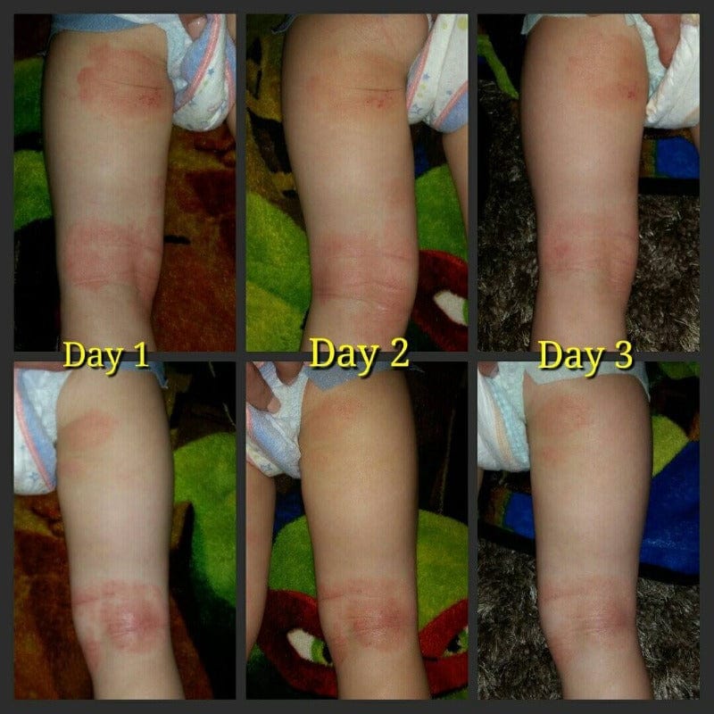SOOTHE MY SKIN EMU OIL CREAM – Nature’s Healing Power Unleashed! From Emu Joy