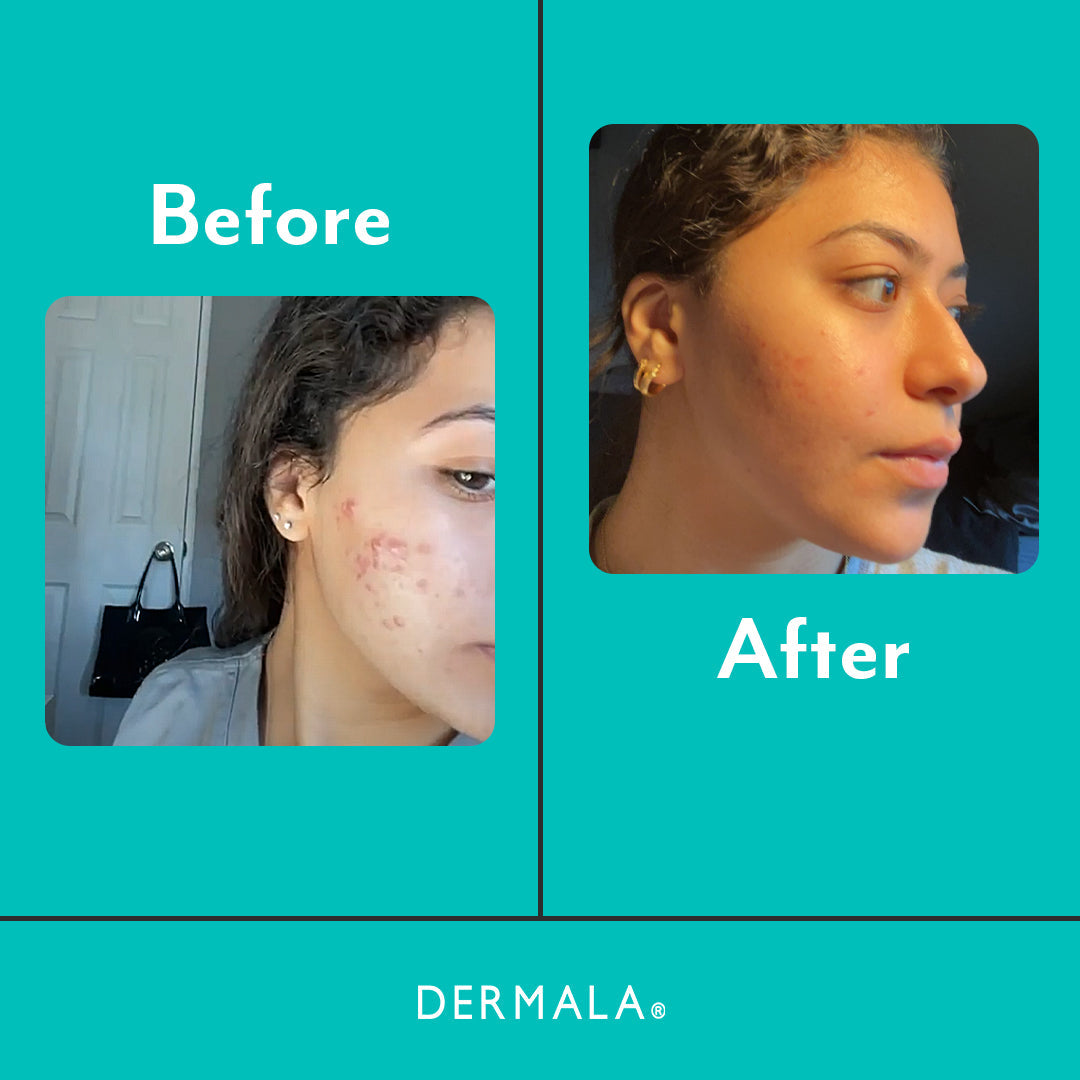 SUPPLEMEANT to Be® - DIM Skin Mix from Dermala