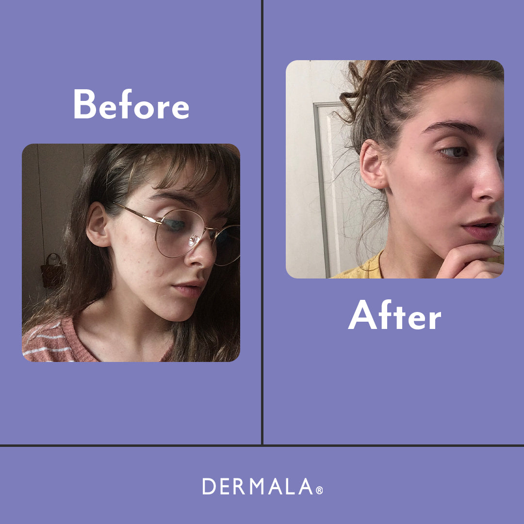 SUPPLEMEANT to Be® Pre+Probiotic+Vitamin Skin Mix from Dermala