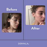 SUPPLEMEANT to Be® Pre+Probiotic+Vitamin Skin Mix from Dermala