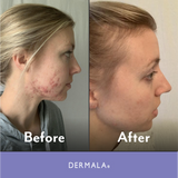 SUPPLEMEANT to Be® Pre+Probiotic+Vitamin Skin Mix from Dermala