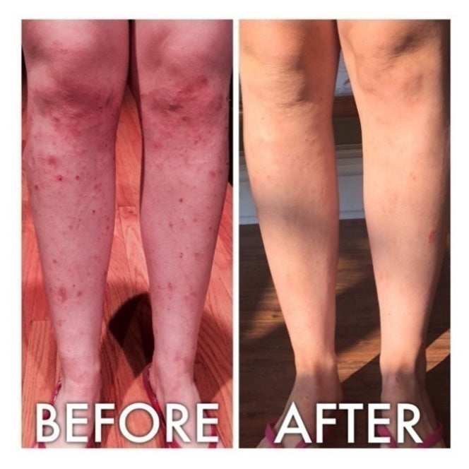 Derm #1 Dry Skin Rescue with Vitamin B3 3.38 oz from Best Clean Beauty