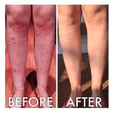 Derm #1 Dry Skin Rescue with Vitamin B3 3.38 oz from Best Clean Beauty