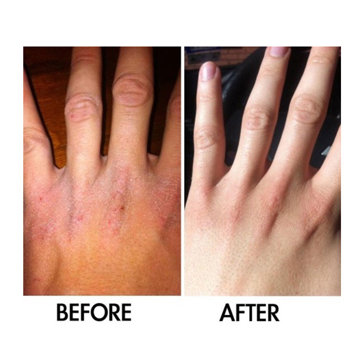 Derm #1 Dry Skin Rescue with Vitamin B3 3.38 oz from Best Clean Beauty