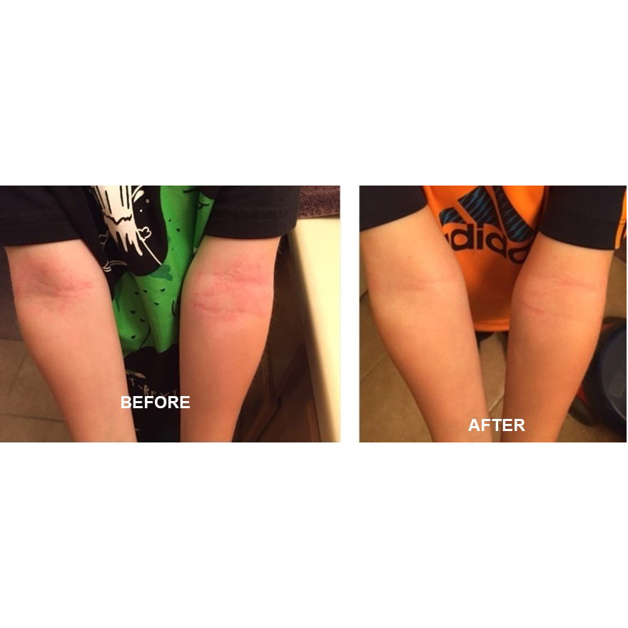 Derm #1 Dry Skin Rescue with Vitamin B3 3.38 oz from Best Clean Beauty