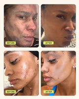 Vitamin C Clay Mask from Gleamin