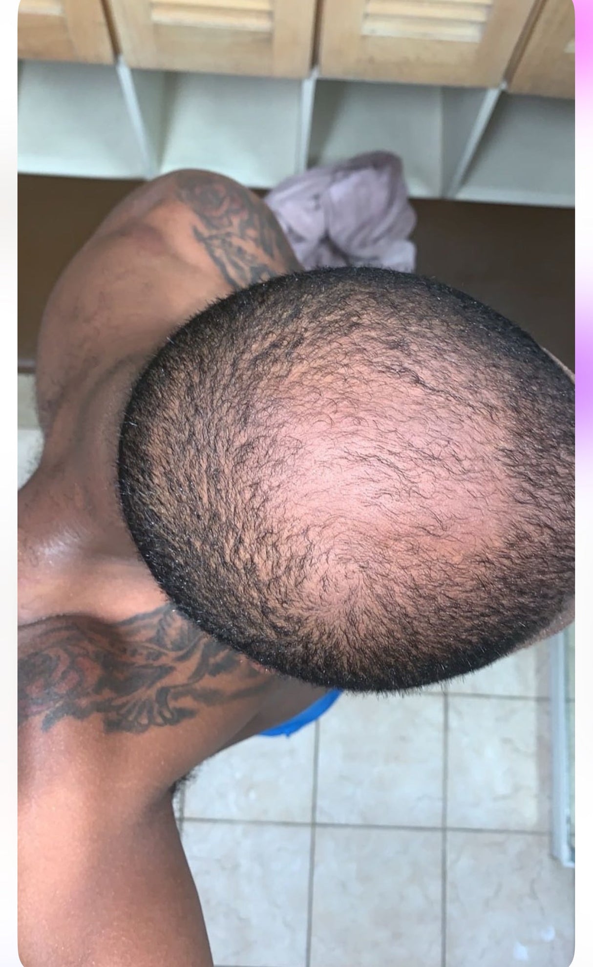 Growth Complex Hair Growth Scalp Stimulator from J’Organic solutions