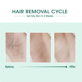 Laser IPL Hair Removal from BeNat
