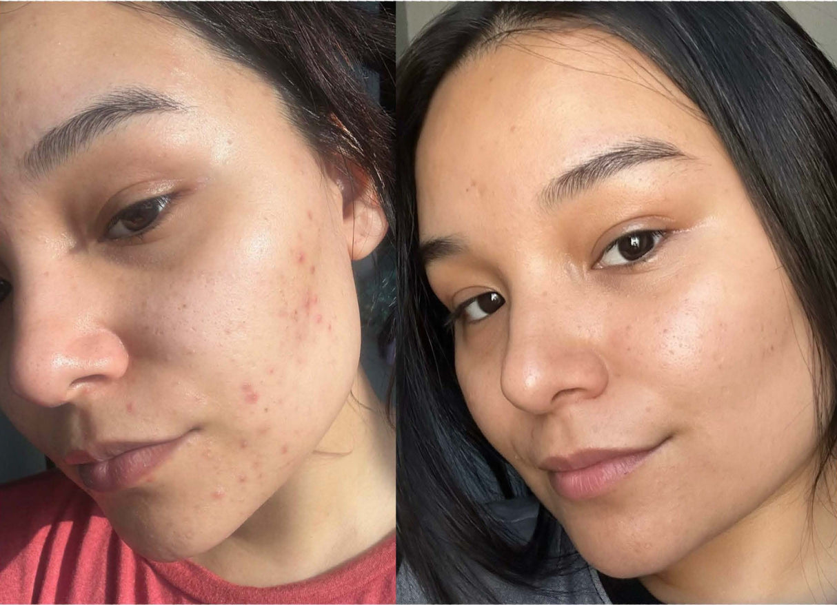 LUCENT From CIRCCELL SKINCARE