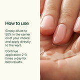 No More Warts KidSafe Essential Oil from Plant Therapy