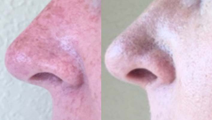LUCENT From CIRCCELL SKINCARE