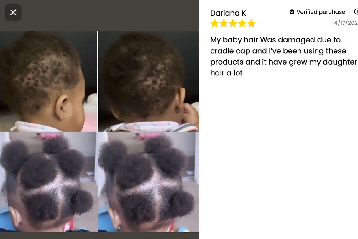 Kid's Hair Growth Scalp Stimulator from J’Organic solutions