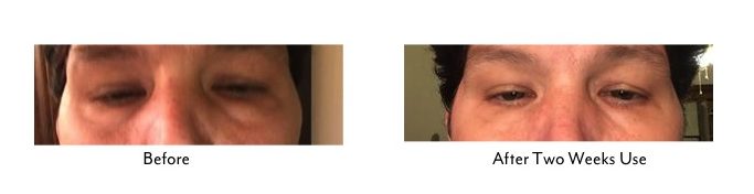 ABO +|- EYE SERUM, REJUVENATING EYE GEL From CIRCCELL SKINCARE