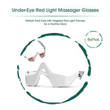 Under-Eye Red Light Therapy Skin Rejuvenation and Relaxation Massager from BeNat