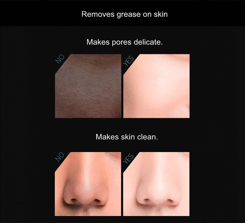 Volcanic Stone Oil-Absorbing Face Roller from BeNat