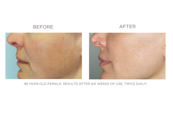 LUCENT From CIRCCELL SKINCARE