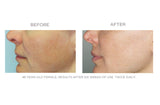 LUCENT From CIRCCELL SKINCARE