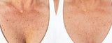 LUCENT From CIRCCELL SKINCARE