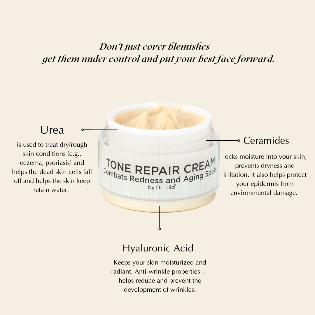 FLASH SALE: Brightening Face Cream for Redness & Hyperpigmentation from Epilynx Skincare and Cosmetics
