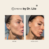 Illuminating Serum with Lactic and Salicylic Acid - Gentle from Epilynx Skincare and Cosmetics