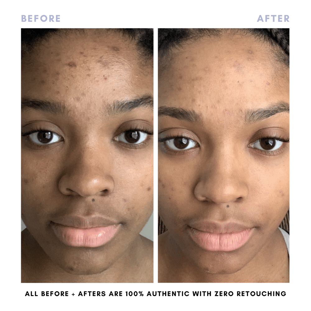 The Complete Skincare Collection From Clover by Clove + Hallow