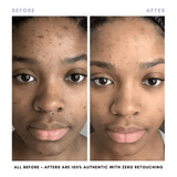 The Complete Skincare Collection From Clover by Clove + Hallow