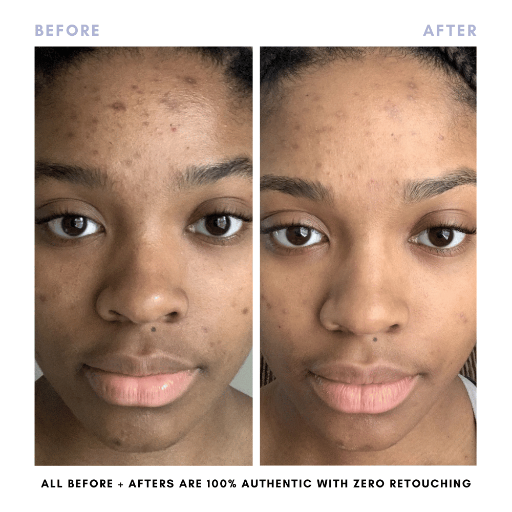The Core Skincare Set From Clover by Clove + Hallow
