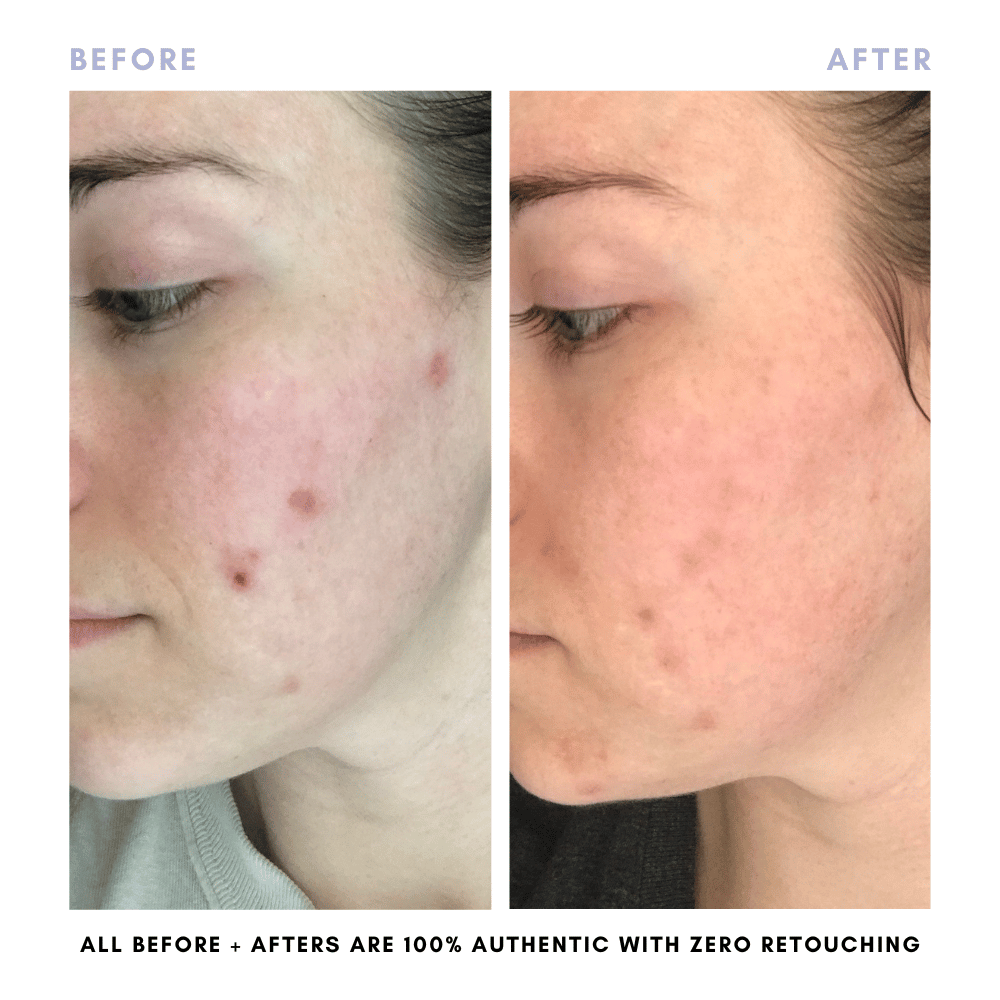 The Core Skincare Set From Clover by Clove + Hallow