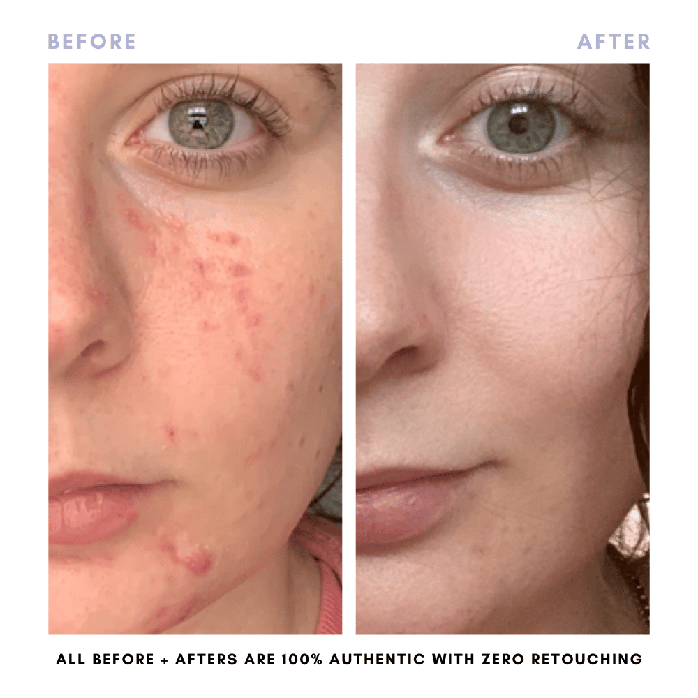 The Double Cleansing Duo From Clover by Clove + Hallow